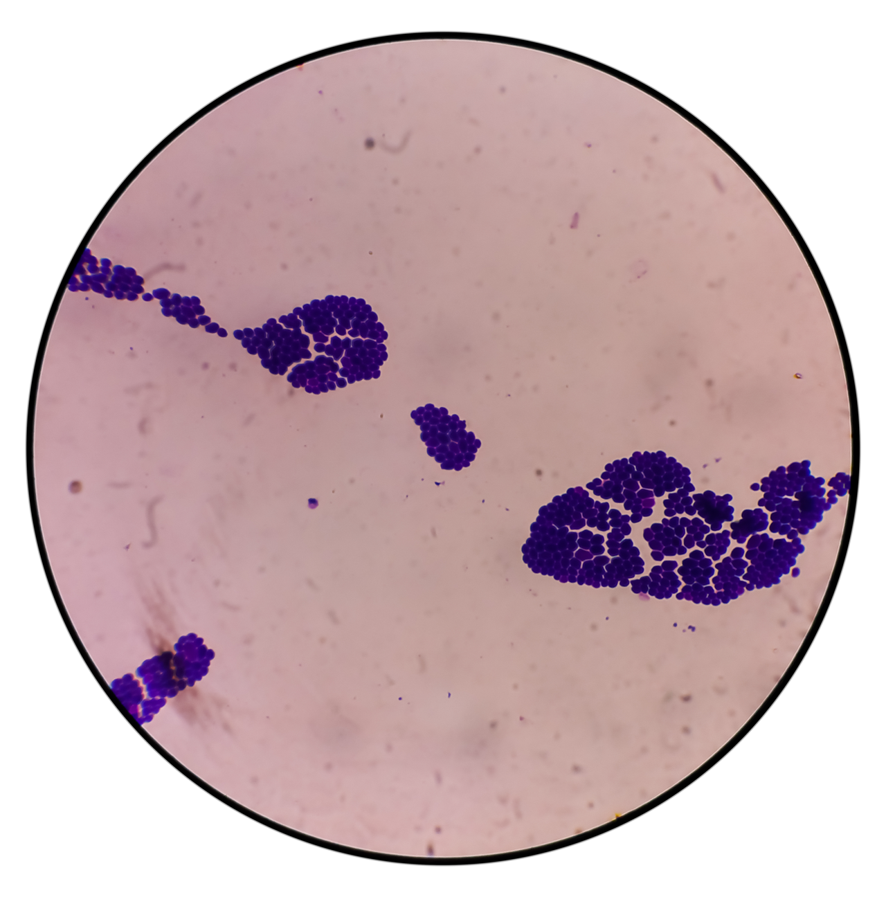 Fungi_C-auris